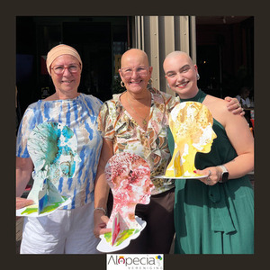 bald-award-josee